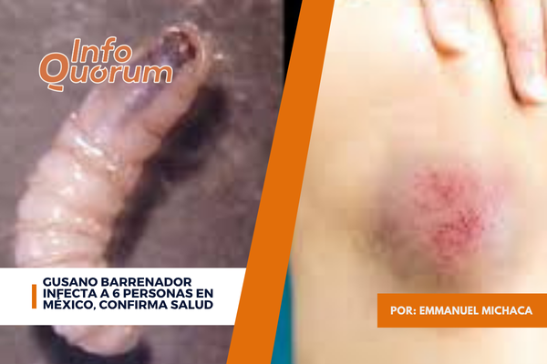 Gusano barrenador infecta a 6 personas en México, confirma Salud