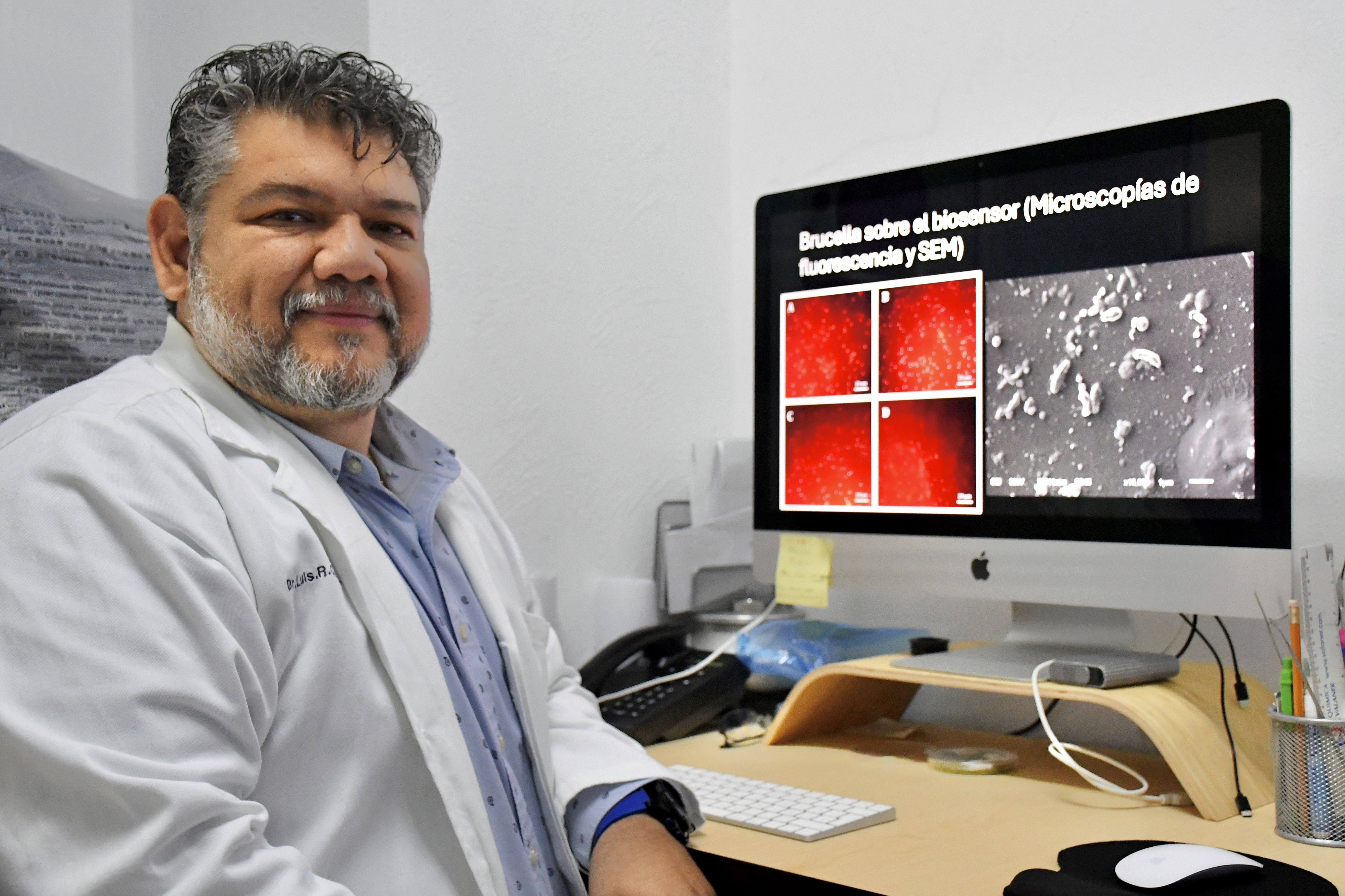 BUAP desarrolla biosensores para detectar bacterias y toxinas